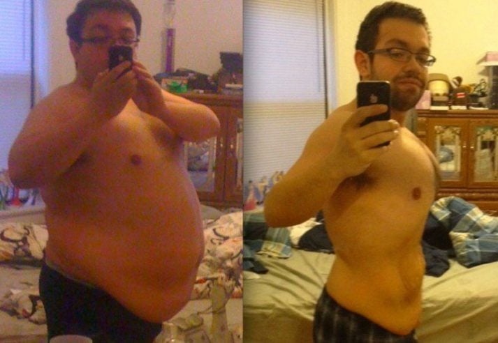 Moobs before And After Weight Loss
